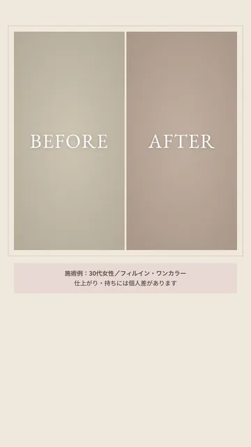 施術事例の紹介の型の見本